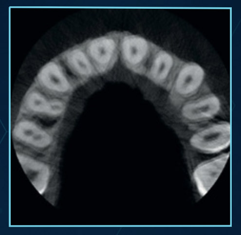 Patient Motion Correction (PMC). Without correction.