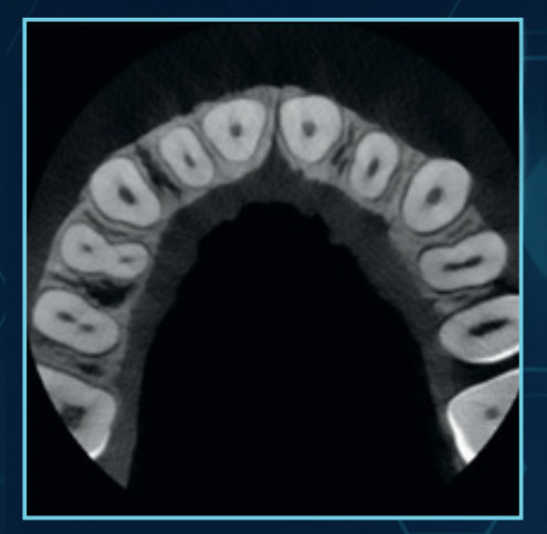 Patient Motion Correction (PMC). With correction