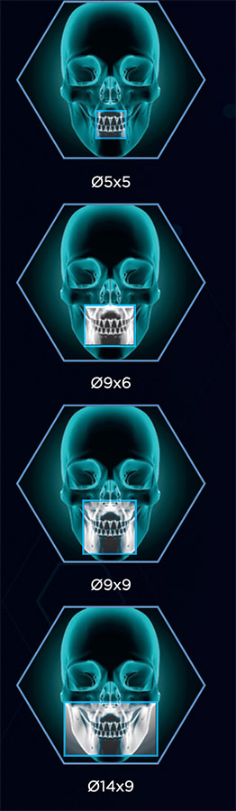 PreXion Endo Unit FOV